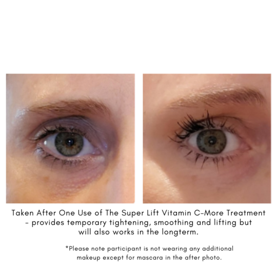 The Super Lift + Vitamin C Results